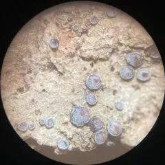 Tricolor Bacidia thumbnail 4