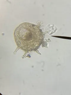 Centropyxis aculeata thumbnail 2