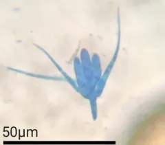 Tetracladium setigerum thumbnail 2