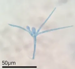 Tetracladium marchalianum thumbnail 4