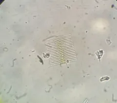 Fragilaria crotonensis thumbnail 3