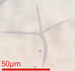 Alatospora acuminata thumbnail 3