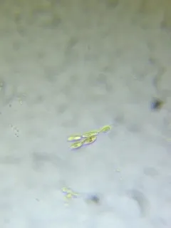 Dinobryon sertularia thumbnail 3
