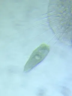 Stentor multiformis thumbnail 1