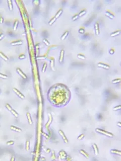 Diplophrys archeri thumbnail 3