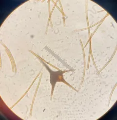 Ceratium hirundinella thumbnail 2