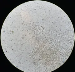 Dacrymyces corticioides thumbnail 2
