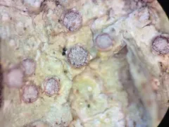 Frosted Ragged-rim Lichen thumbnail 3
