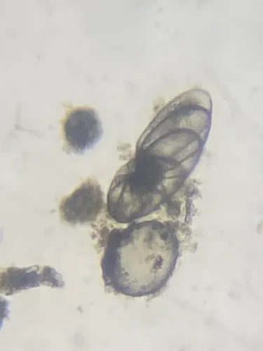 Nonionella auris