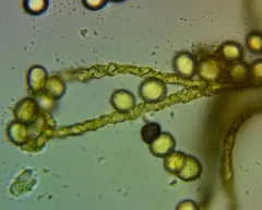 Hemitrichia montana thumbnail 3