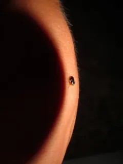 Clastoptera testacea thumbnail 3