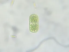 Cylindrocystis brebissonii thumbnail 3