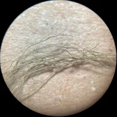 Mountain Horsehair Lichen thumbnail 3