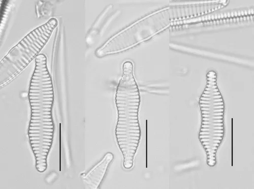 Staurosira binodis