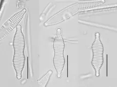 Staurosira binodis thumbnail 1