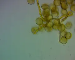 Trichia contorta thumbnail 4