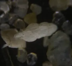 Uvigerina peregrina thumbnail 1