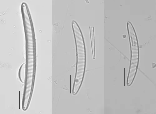 Eunotia bilunaris