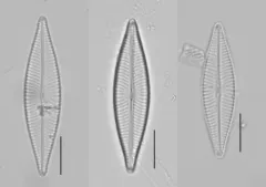 Navicula trivialis thumbnail 2