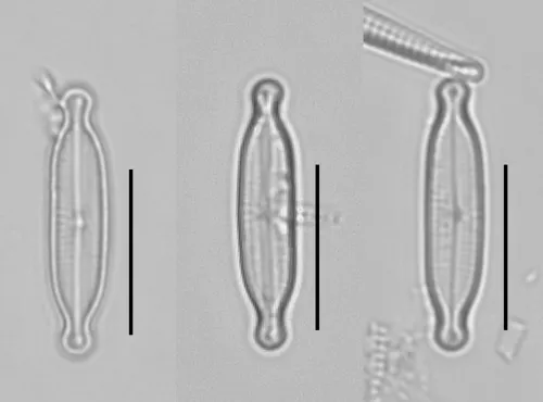 Encyonopsis microcephala
