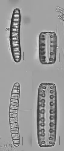Epithemia argus