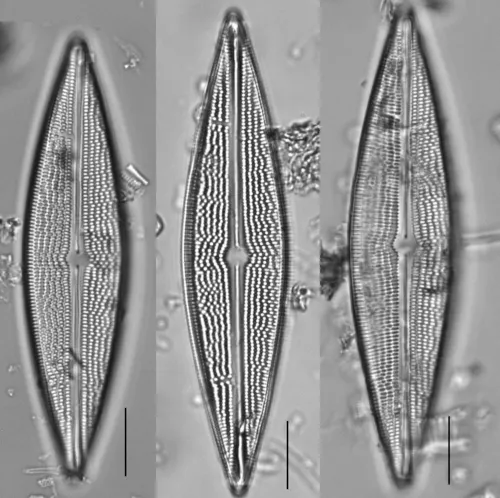 Brachysira serians