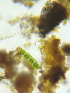 Planotaenium interruptum thumbnail 2