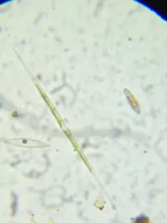 Closterium aciculare thumbnail 2