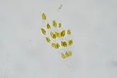 Dinobryon sertularia thumbnail 1
