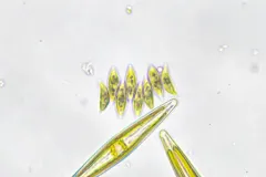 Tetradesmus obliquus thumbnail 2