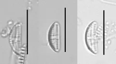 Amphora pediculus thumbnail 2