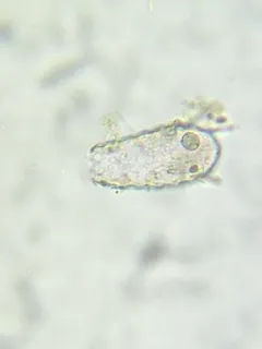 Euglypha acanthophora thumbnail 1
