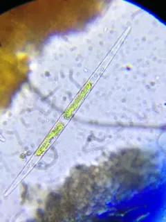 Closterium acutum thumbnail 1