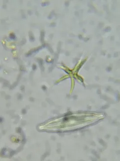 Tetradesmus lagerheimii thumbnail 4