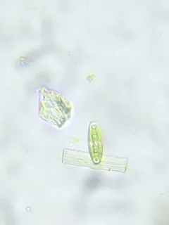 Closterium navicula thumbnail 4