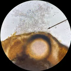 Didymocyrtis xanthomendozae thumbnail 2