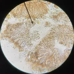 Nesolechia oxyspora thumbnail 2