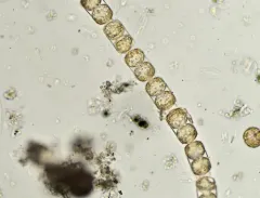 Melosira inflexa thumbnail 1