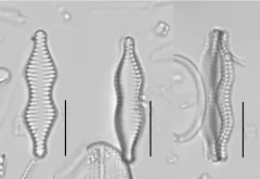 Staurosira binodis thumbnail 2