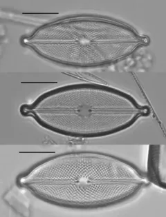 Decussiphycus placenta thumbnail 3