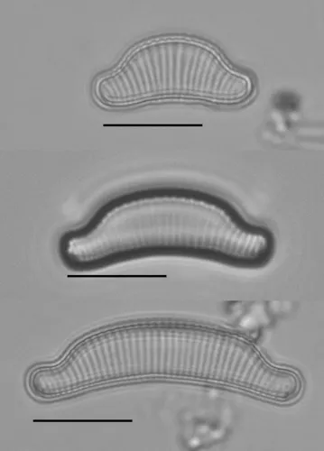 Eunotia arcus