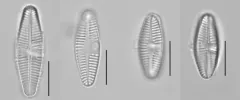 Planothidium lanceolatum thumbnail 1