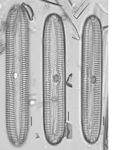 Pinnularia streptoraphe thumbnail 1