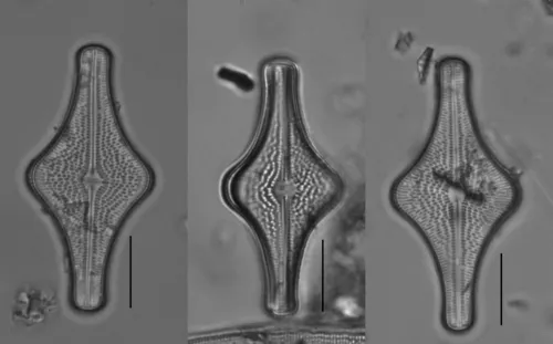 Brachysira follis