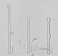 Tabellaria fenestrata thumbnail 2
