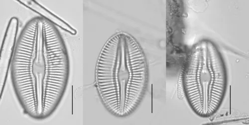 Diploneis dilatata