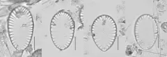 Surirella brebissonii thumbnail 1