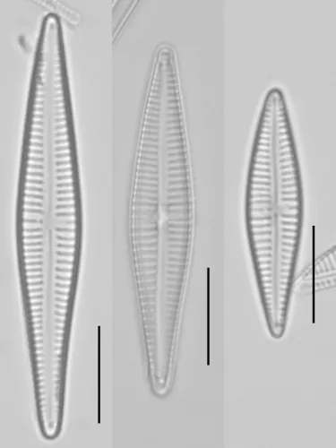 Gomphonema gracile