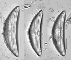 Amphora ovalis thumbnail 3