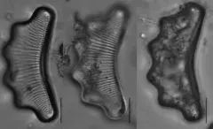Eunotia tetraodon thumbnail 2